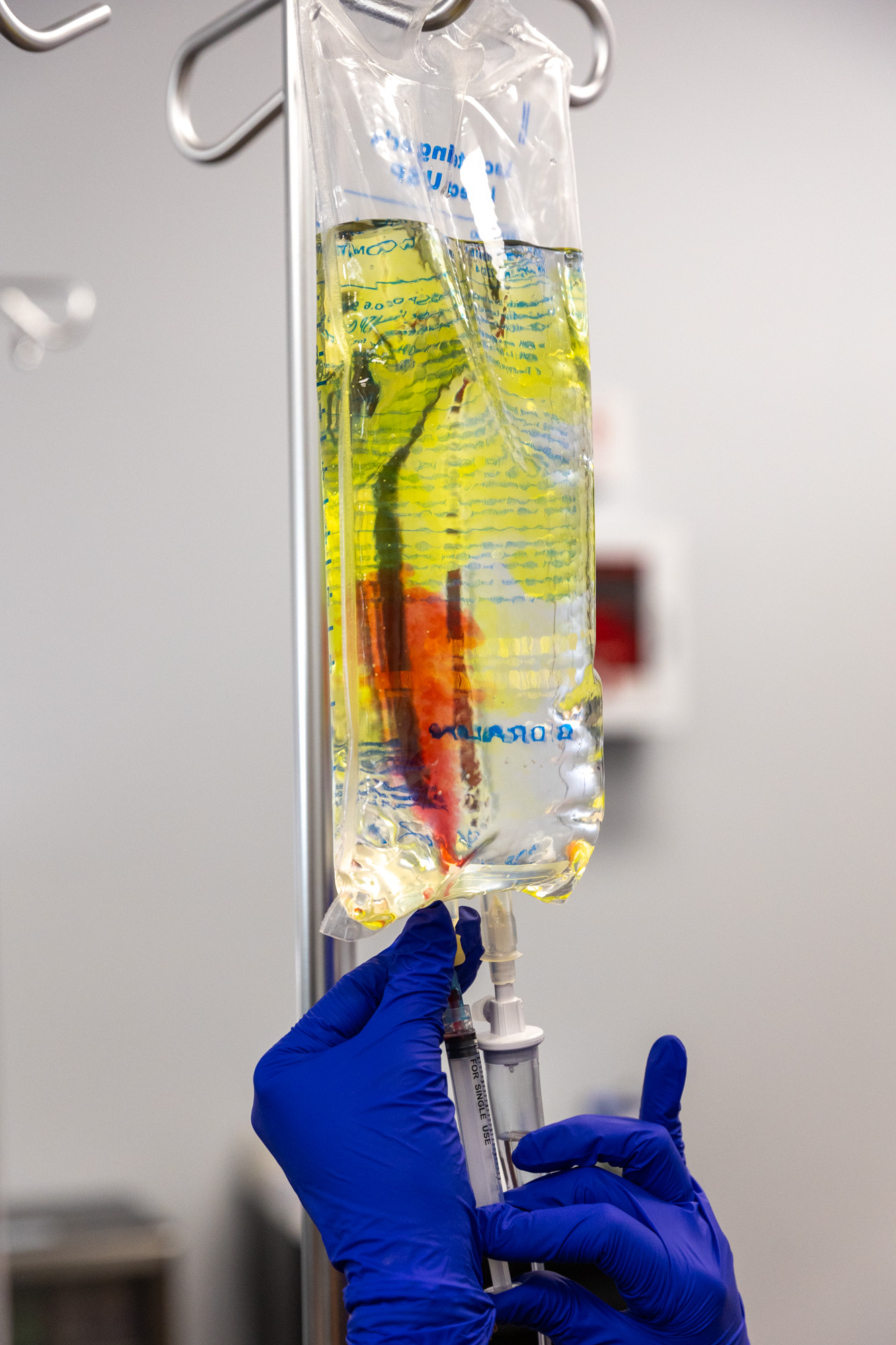 Close-up of a nurse with blue gloves preparing an IV bag for an immunity boost in Nashville